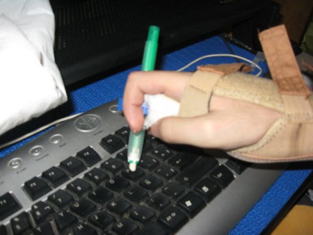 Splint for typing